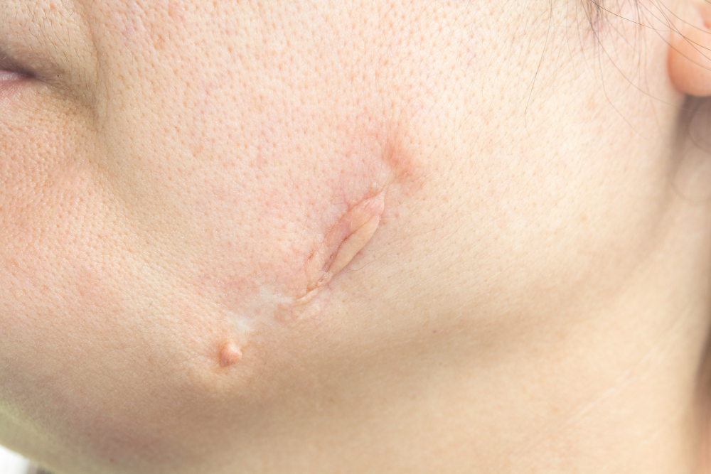 big scar face